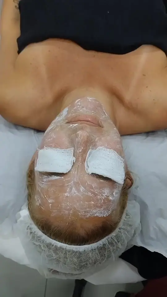 Limpeza de pele realizada no Espaço Evidence